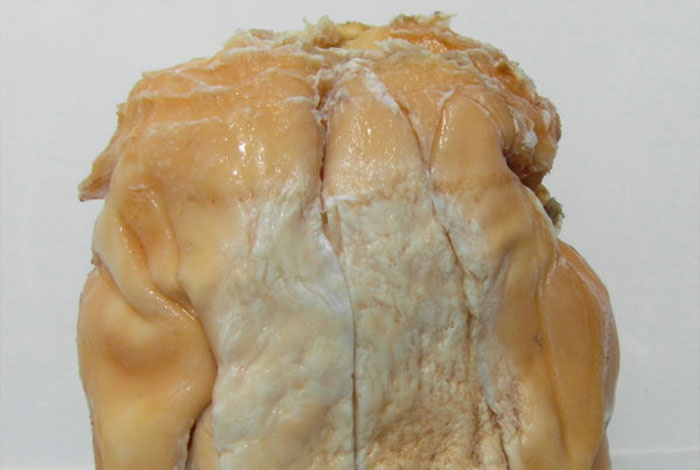 ̫��ʲô�����г���̬��ʱ